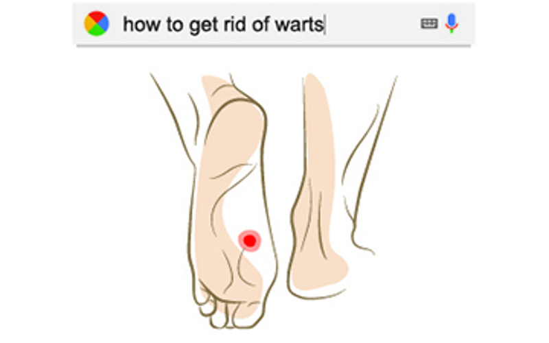 What is Autoimmune Therapy (also known as Needling Warts)?