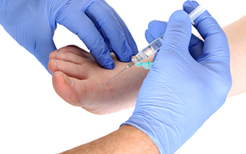 What Are Alcohol Injections?