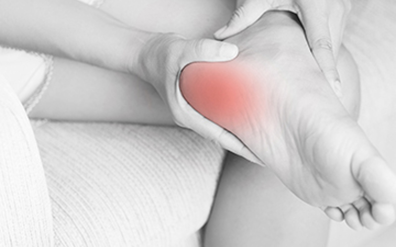 What is a Fasciotomy?