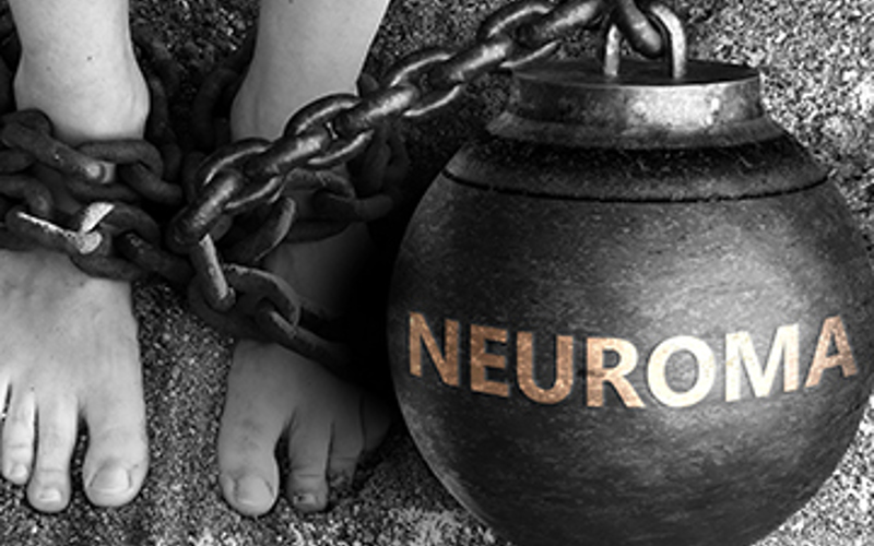 What is a Neuroma?