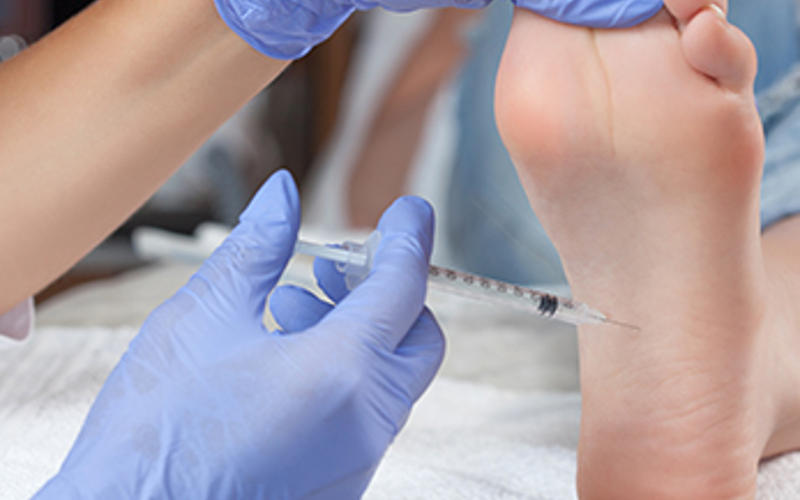 Cortisone Injections for Your Feet