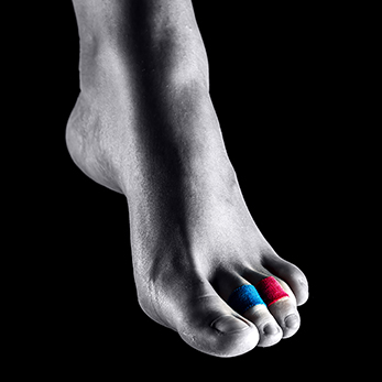 Chiropody - Podiatry Treatments